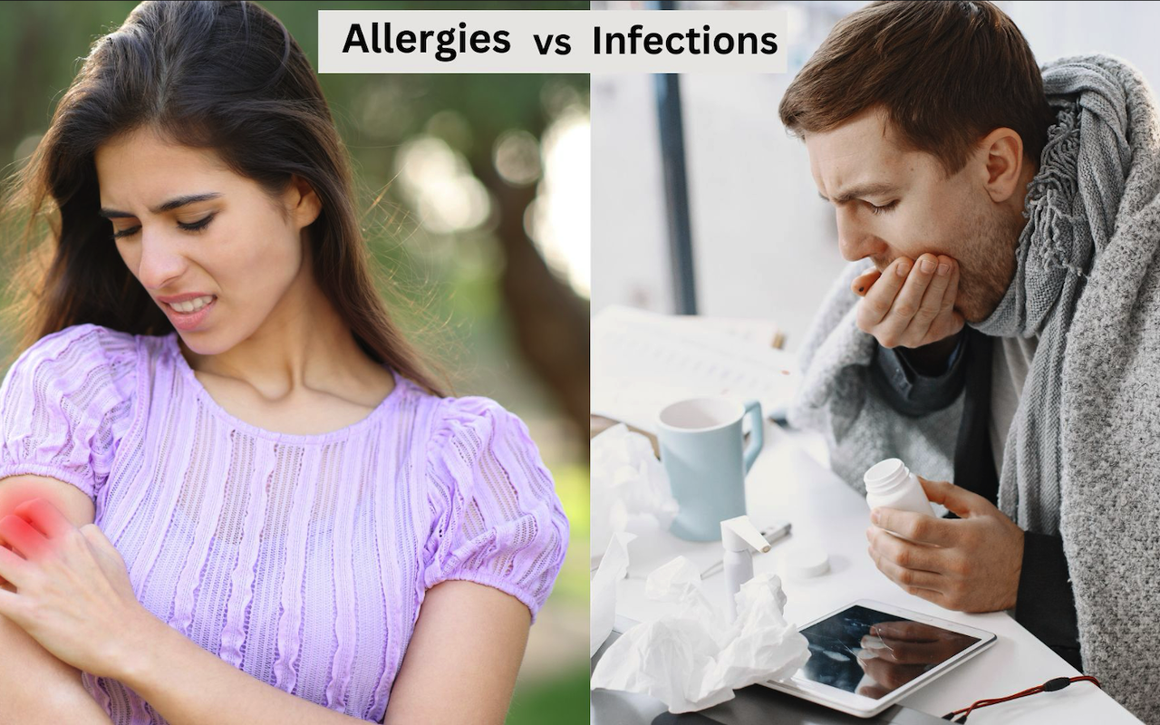 Allergies vs. Infections